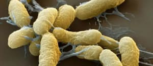 “Yersinia pestis integra la categoría A de agentes de bioterrorismo”, afirma un infectólogo