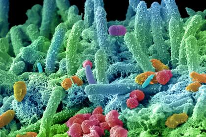 La boca posee un gran número de bacterias muchas pueden ser inofensivas y muchas dañinas para el cuerpo humano