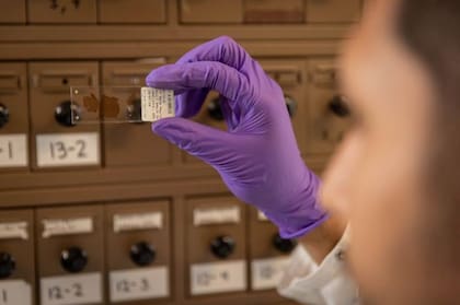 La cadena ligera de neurofilamento experimenta un incremento drástico en la sangre mucho antes de la fase sintomática
