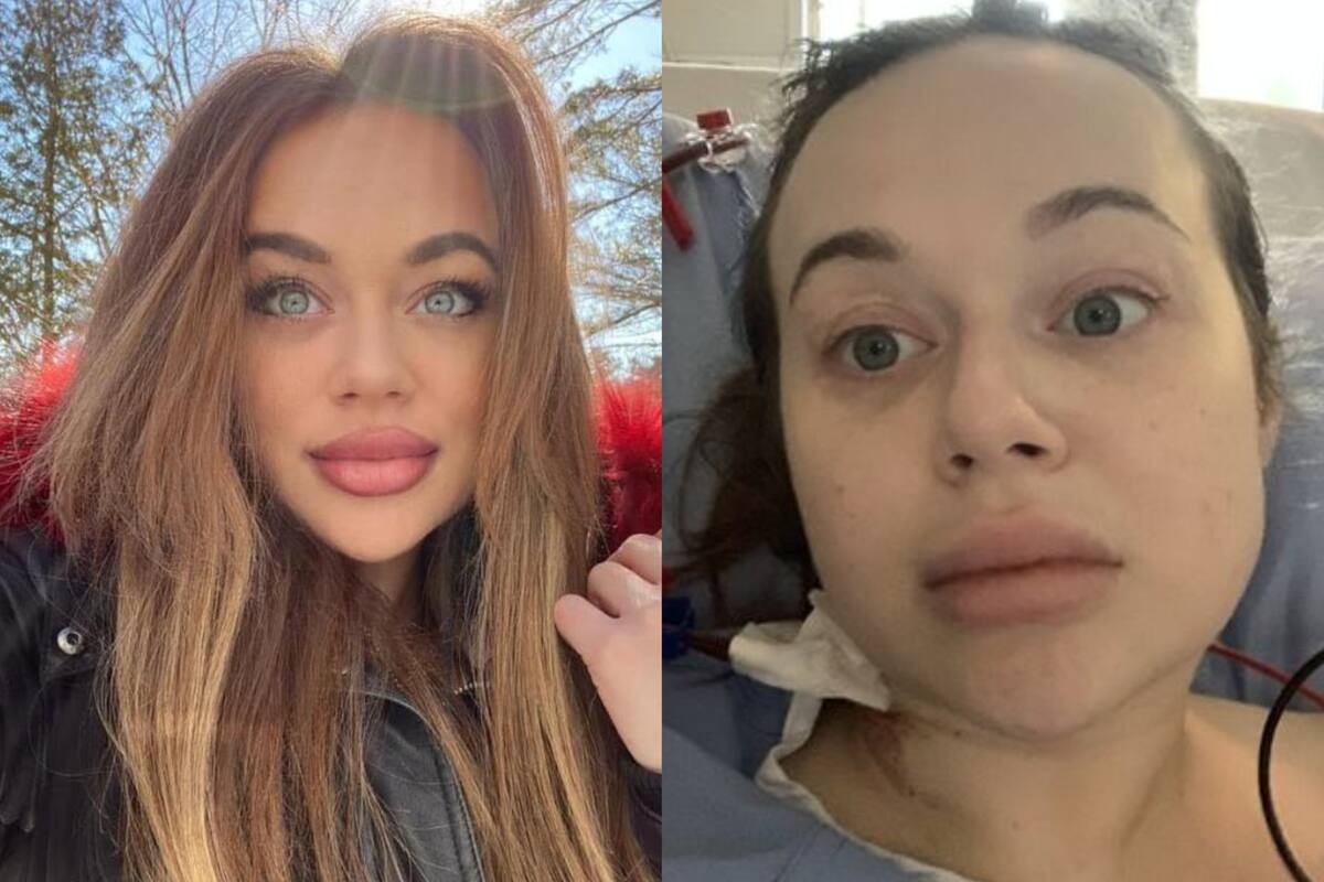 La canadiense cayó inconsciente durante varias horas y cuando despertó tenía las piernas dormidas e hinchadas (Foto: Facebook julialauren)