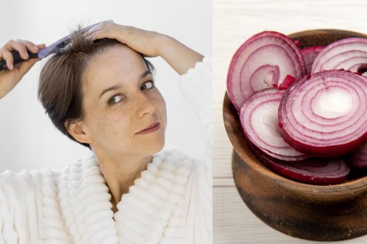 La cebolla contiene antioxidantes y propiedades antimicrobianas que favorecen la salud del cuero cabelludo