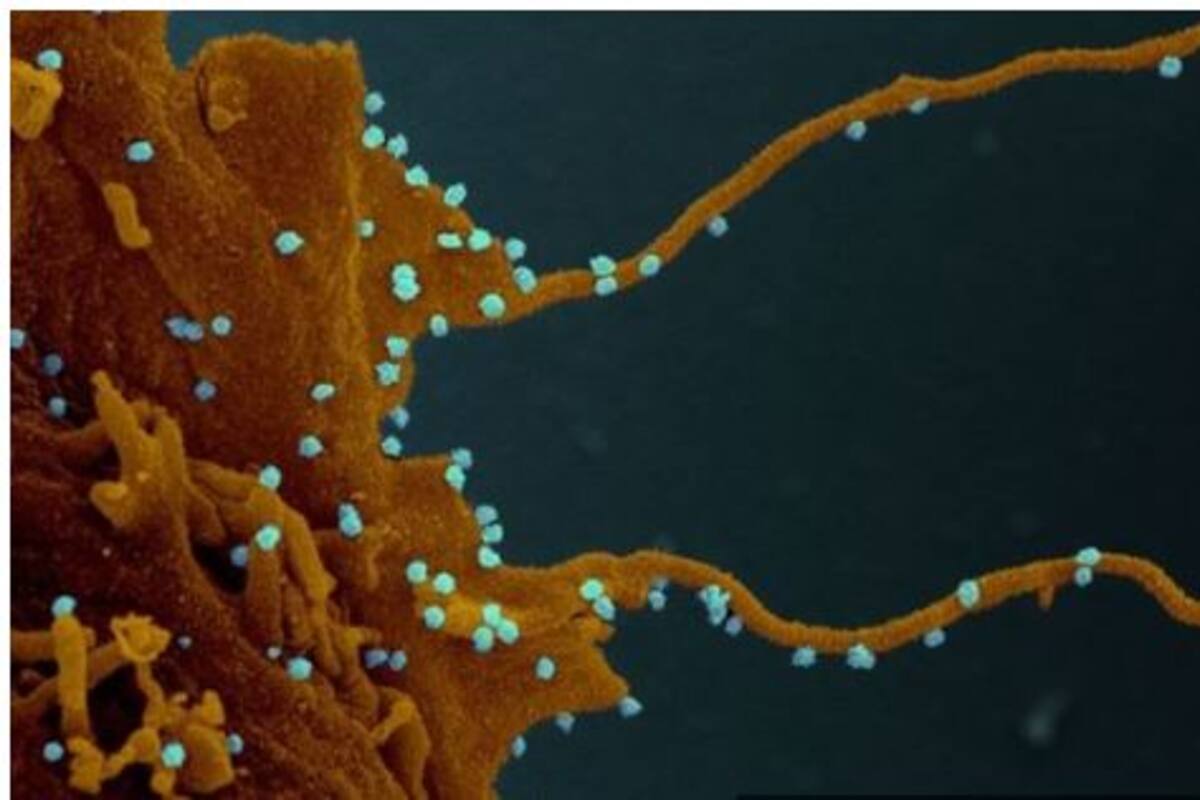 La célula infectada, siguiendo las instrucciones del virus (en azul), desarrolla largos tentáculos para infectar otras células