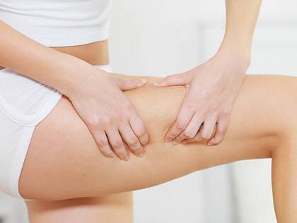 Female squeezes cellulite skin on her legs - close-up fragment