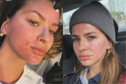 La China Suárez se hizo un retoque estético y sorprendió a todos al mostrar el resultado (Foto: Instagram @sangrejaponesa)