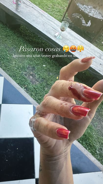 La China Suárez tuvo un accidente en su jardín (Foto: captura/Instagram/@sangrejaponesa)