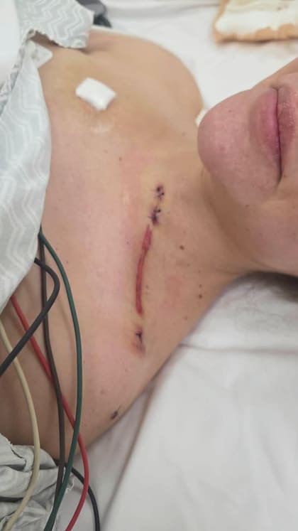 La cicatriz en el cuello de Nadia Beller