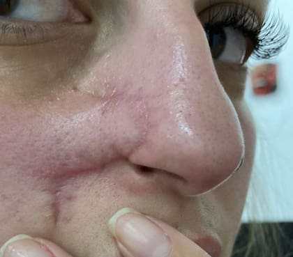 La cirugía dejó una marca en el rostro de Daiane