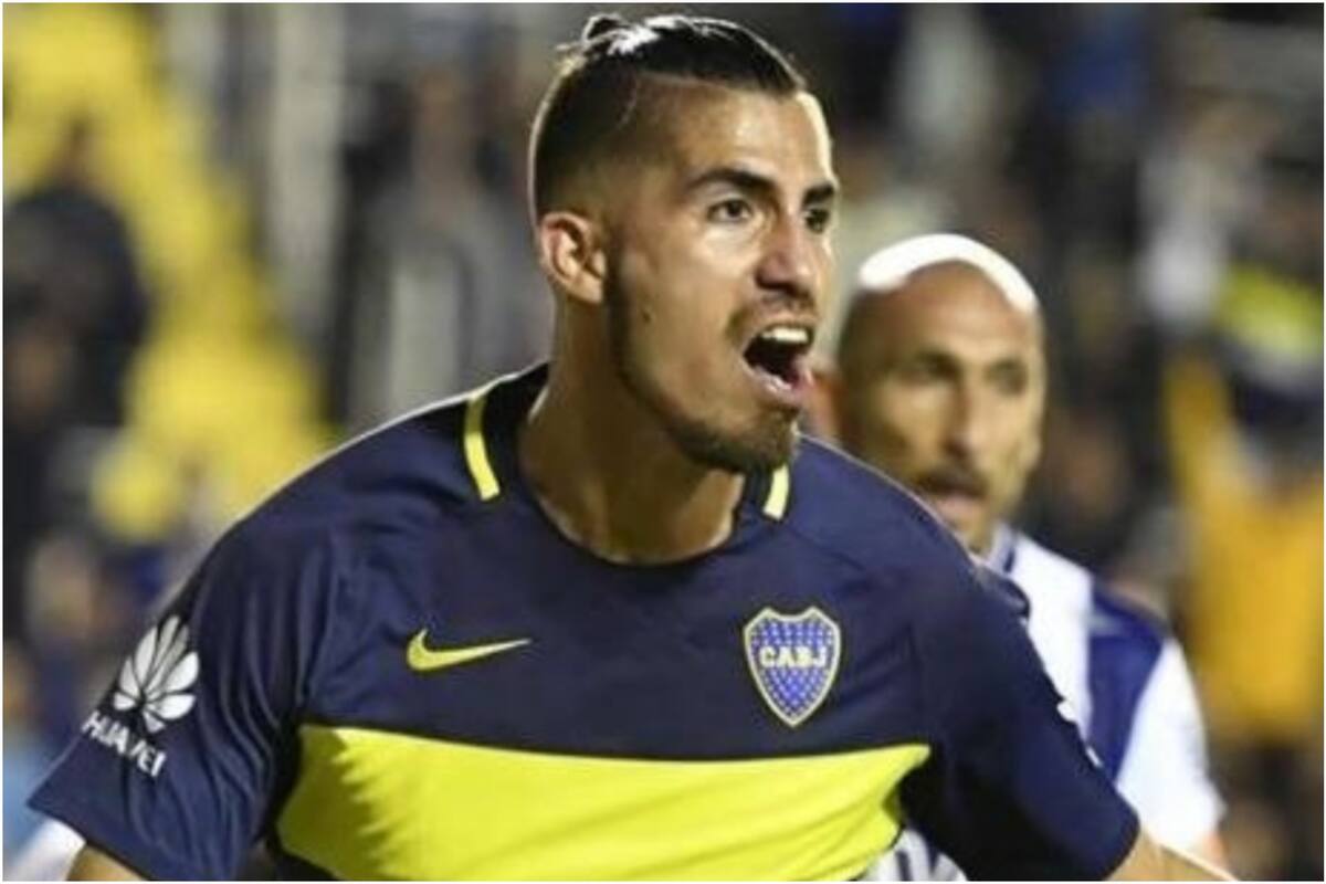 La cirugía estética que atravesó Junior Benítez