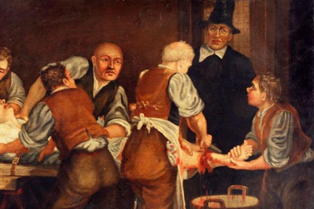 La cirugía no era una cuestión de precisión delicada, sino cruda, sangrienta, a menudo caótica... Y antihigiénica.