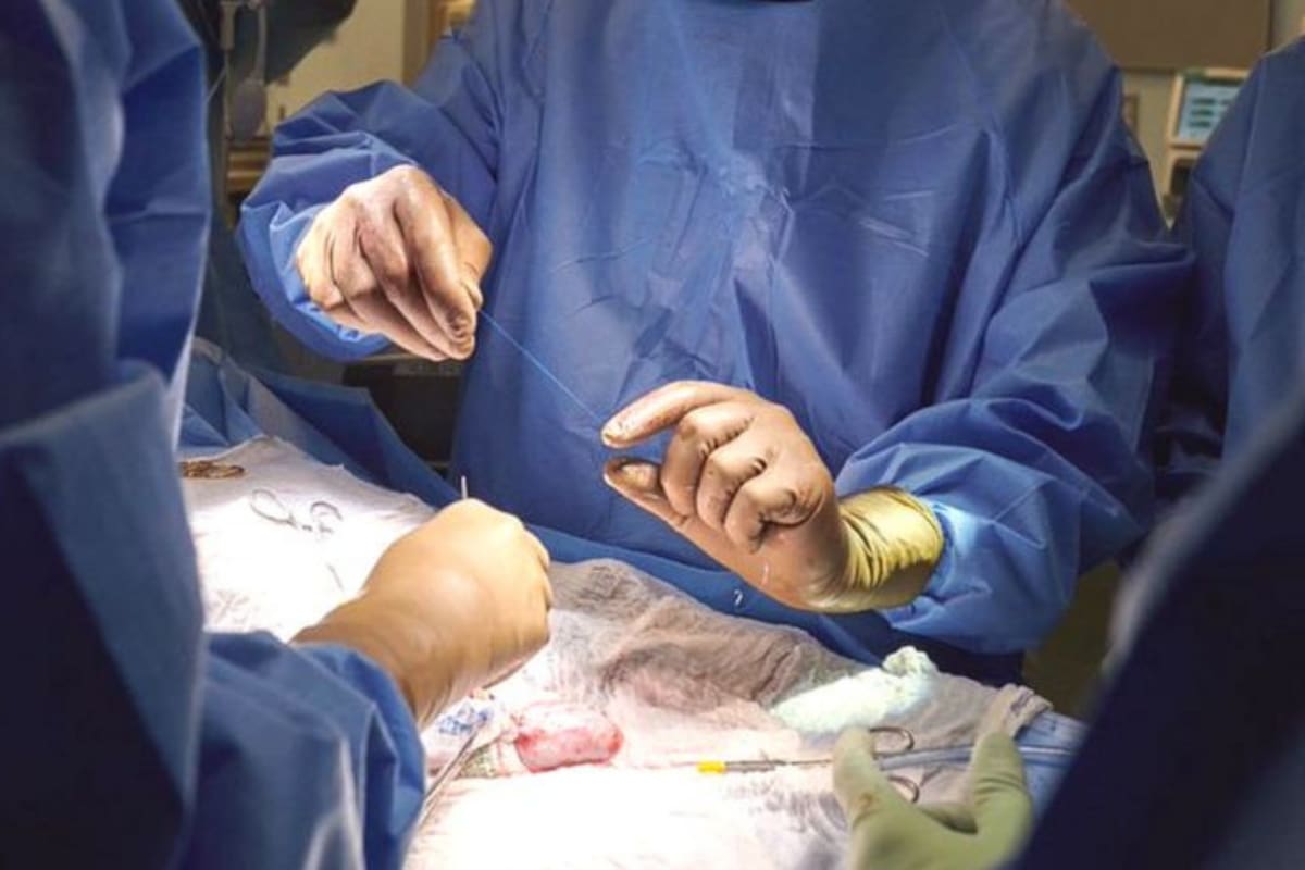 La cirugía se realizó durante dos horas