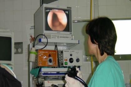 La colonoscopía es un método eficaz para detectar pólipos en colon y recto