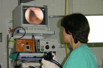 La colonoscopía es un método eficaz para detectar pólipos en colon y recto
