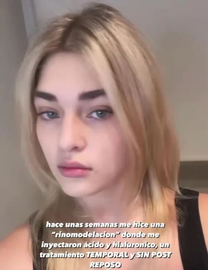 La confesión de Martita Fort sobre un cambio estético en su rostro
Foto: captura de pantalla