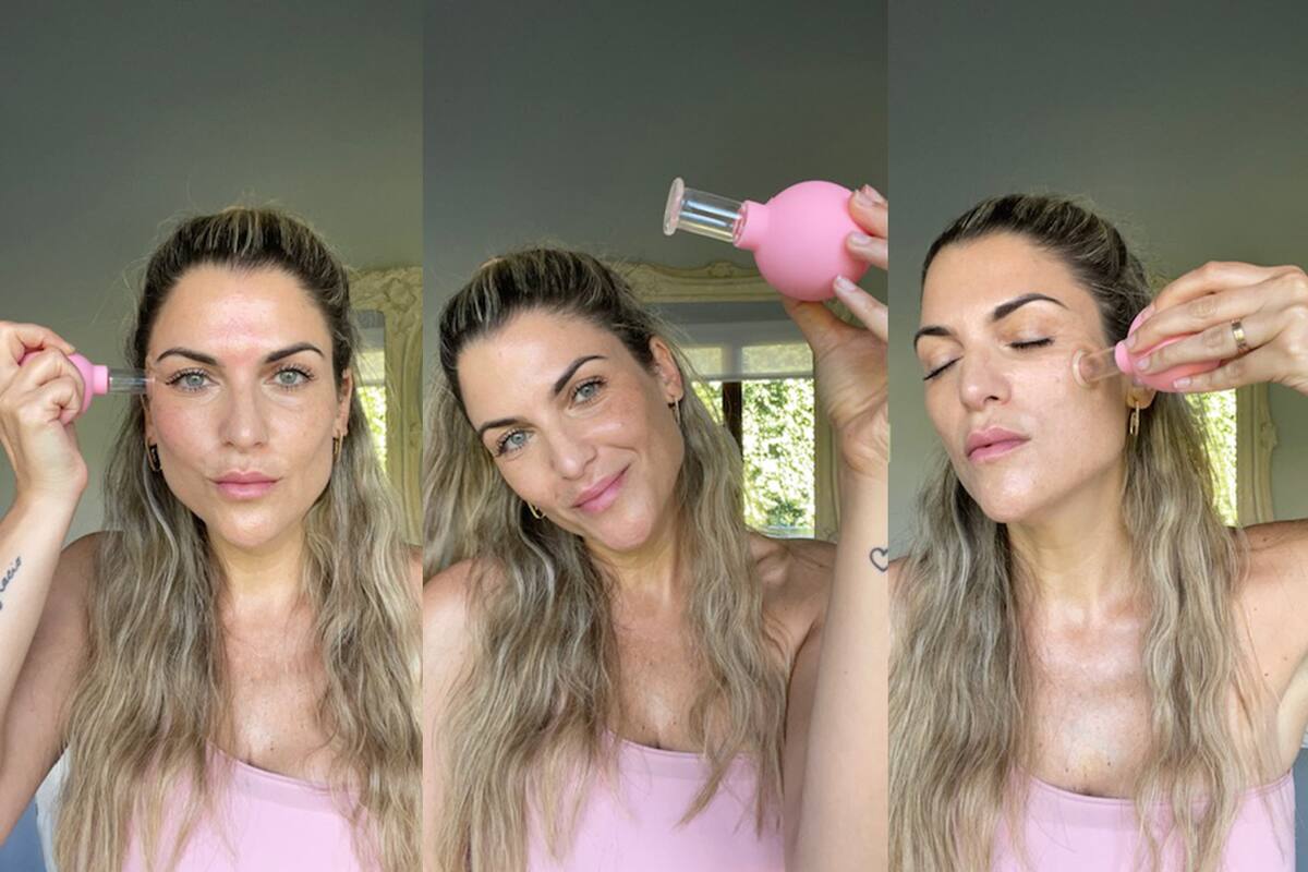La cosmiatra Lorena Erlijman enseña en sus redes el cupping, una de las técnicas de moda