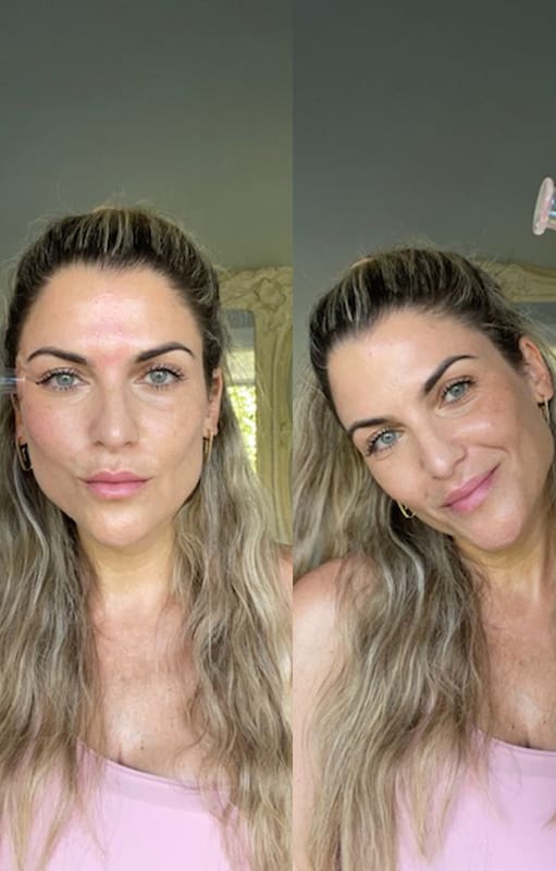 La cosmiatra Lorena Erlijman enseña en sus redes el cupping, una de las técnicas de moda