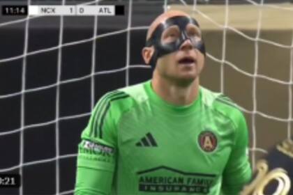 La decepción de Brad Guzan, que volvió hacia el arco de Atlanta United en una acción rápida, se llevó por delante la pelota y metió el gol en contra que festejó Necaxa
