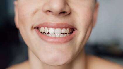 La dieta es fundamental para cuidar el microbioma oral