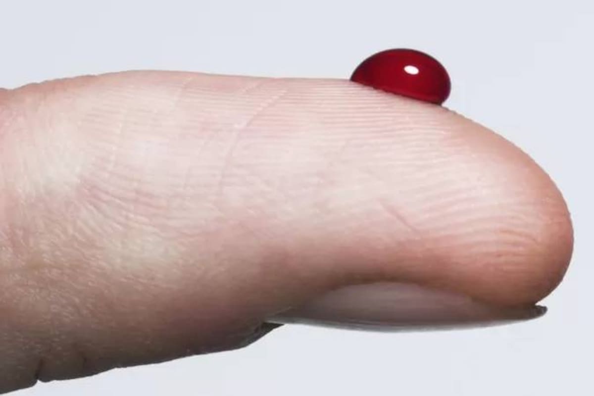 La dificultad para controlar bien la glucemia (el “azúcar” en sangre) genera complicaciones