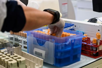 El grupo de Oxford está enfocando el reclutamiento de voluntarios entre los trabajadores de la salud, "porque es el grupo con mayor índice de contagios"