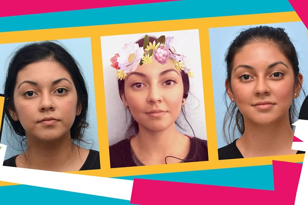 La dismorfia de Snapchat es el nombre que se le da a la afición por las cirugías estéticas para tener el rostro que nos muestra una selfie con filtros