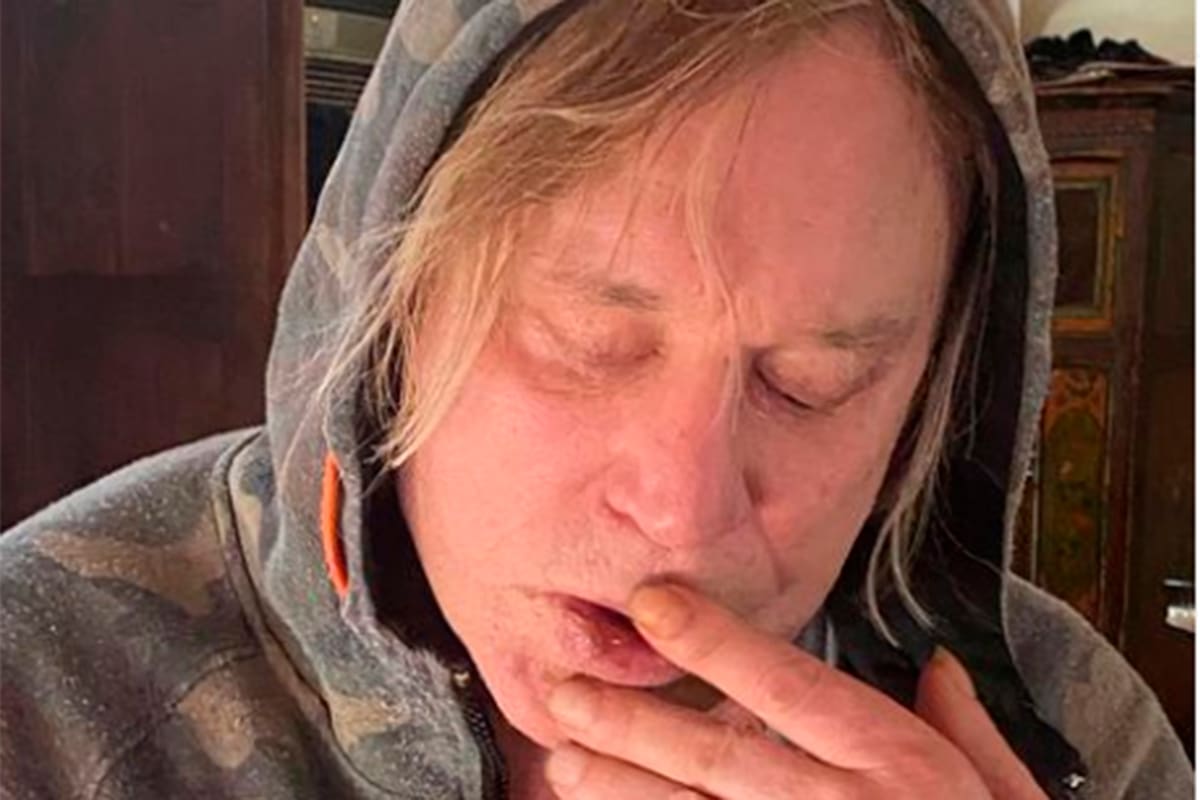 La drástica decisión de Mickey Rourke, tras sufrir un fuerte golpe: “Parece que mis días de skate han terminado”