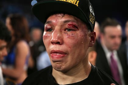La dura batalla entre Matthysse y Provodnikov