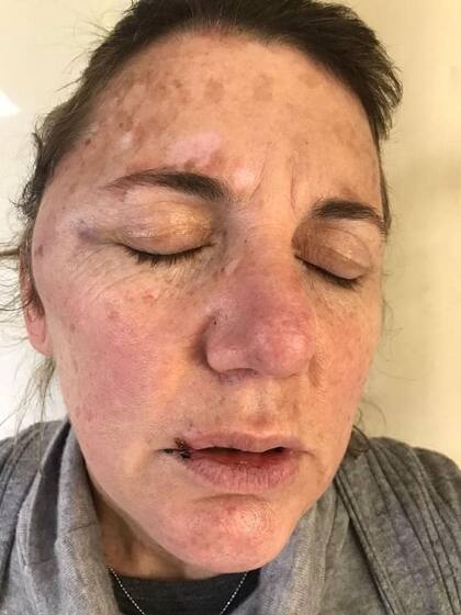 La empleada fue brutalmente agredida por el ladrón, que se fue caminando del local con la recaudación. "Esto no se aguanta más", advirtieron los residentes de la zona