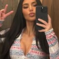 Kim Kardashian habla por primera vez de su problema de salud y revela su diagnóstico