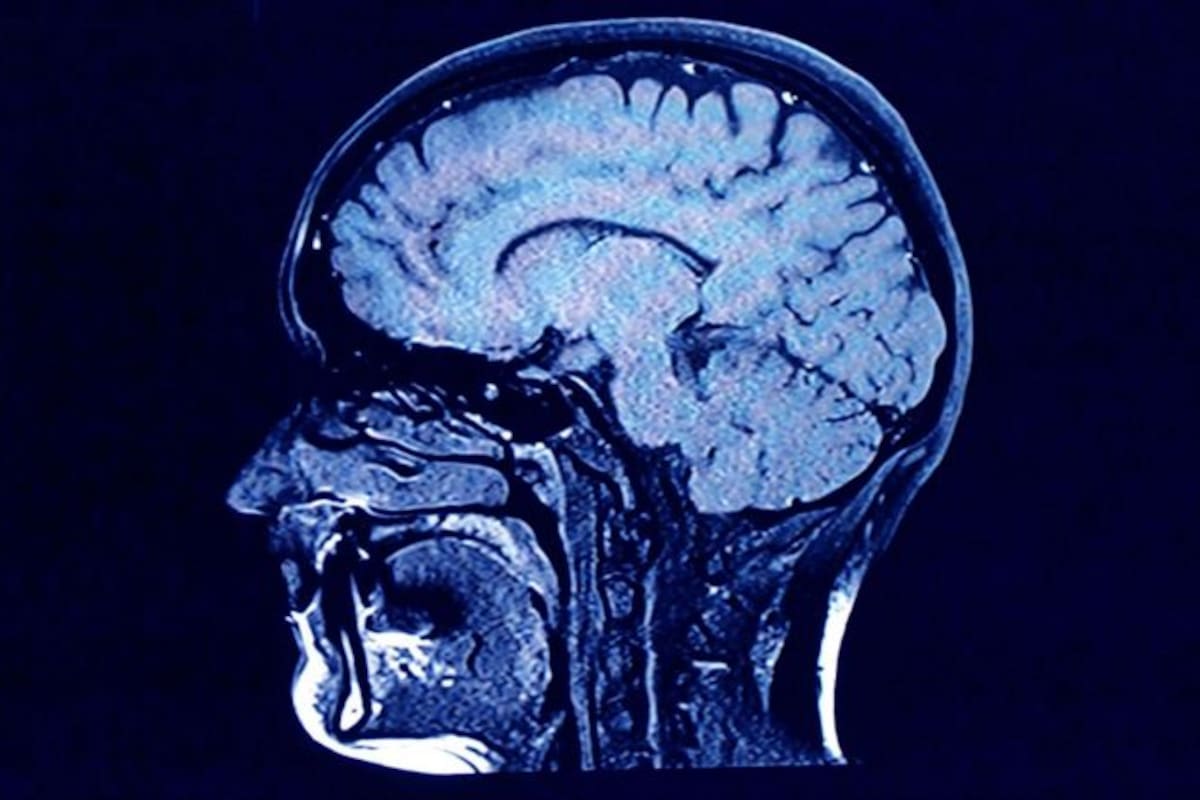 La Esclerosis Lateral Amiotrófica aún está rodeada de interrogantes vinculados a su origen y tratamiento