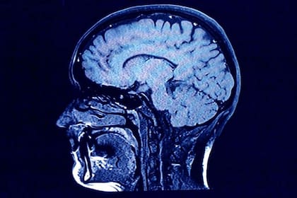 La Esclerosis Lateral Amiotrófica aún está rodeada de interrogantes vinculados a su origen y tratamiento