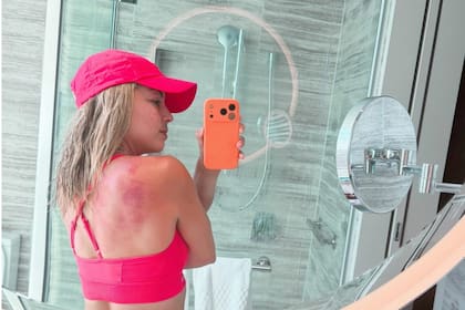 La exposición solar extrema durante la competencia profesional genera preocupación en el circuito femenino