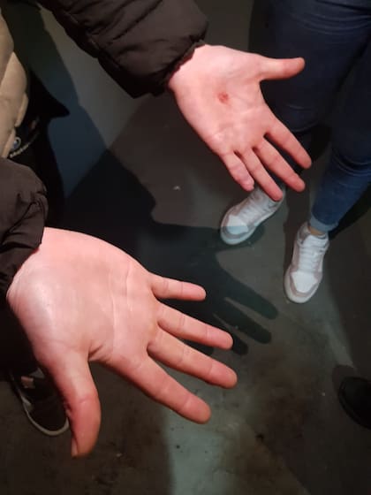 La familia de la víctima lo desmintió. Un joven de 26 años falleció de un disparo y un amigo le dijo a la Policía que se le escapó un tiro al manipular un arma.