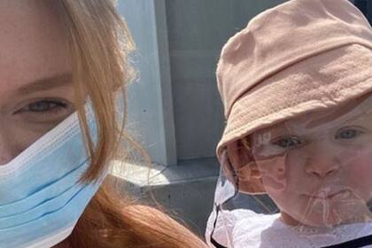 La familia vive en Londres y tras ver el rasguño de la pequeña hija se trasladaron de emergencia al hospital