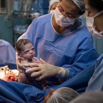 La foto original de la bebé que nació "enojada" (Foto: Instagram)