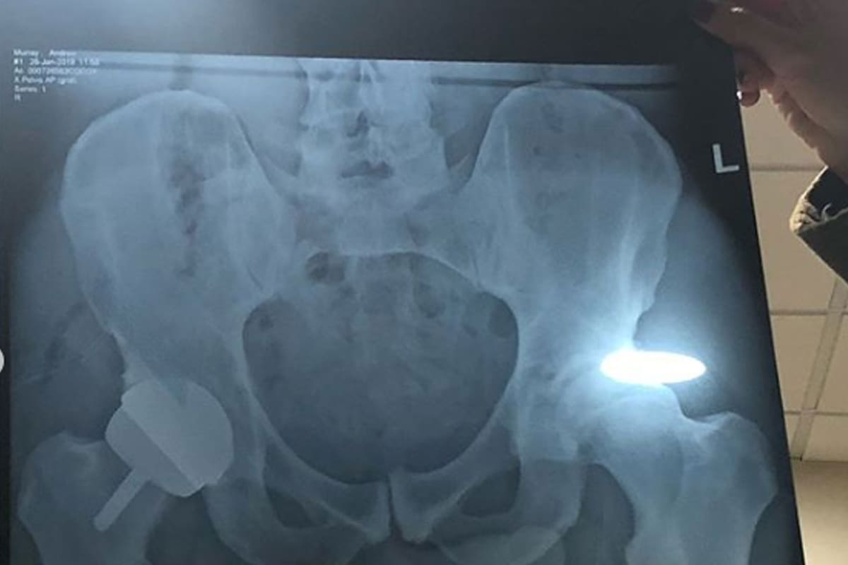 La foto que publicó Andy Murray luego de su operación de cadera
