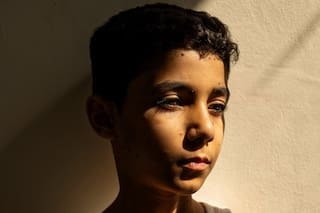 La historia detrás de la impactante imagen del niño mutilado en Gaza