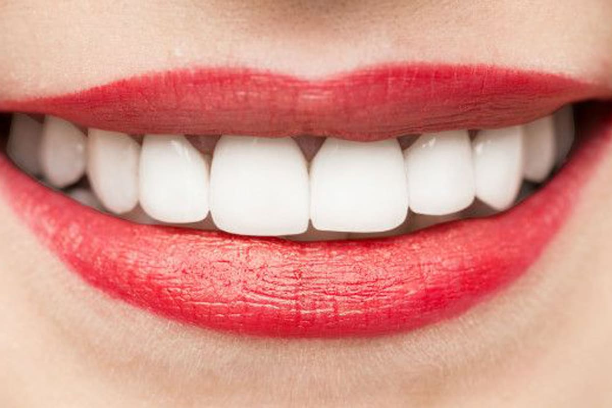 La genética puede influir en el blanco de tus dientes.