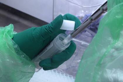 La glándulas salivares son el primer lugar del cuerpo que infecta el virus