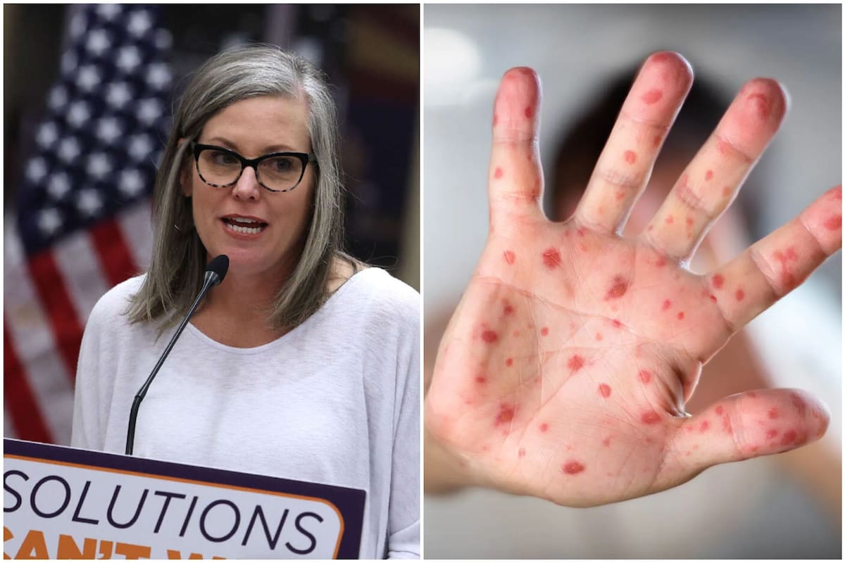 La gobernadora de Arizona mantiene vigilancia sobre la circulación del virus del sarampión en el estado y emite una alerta