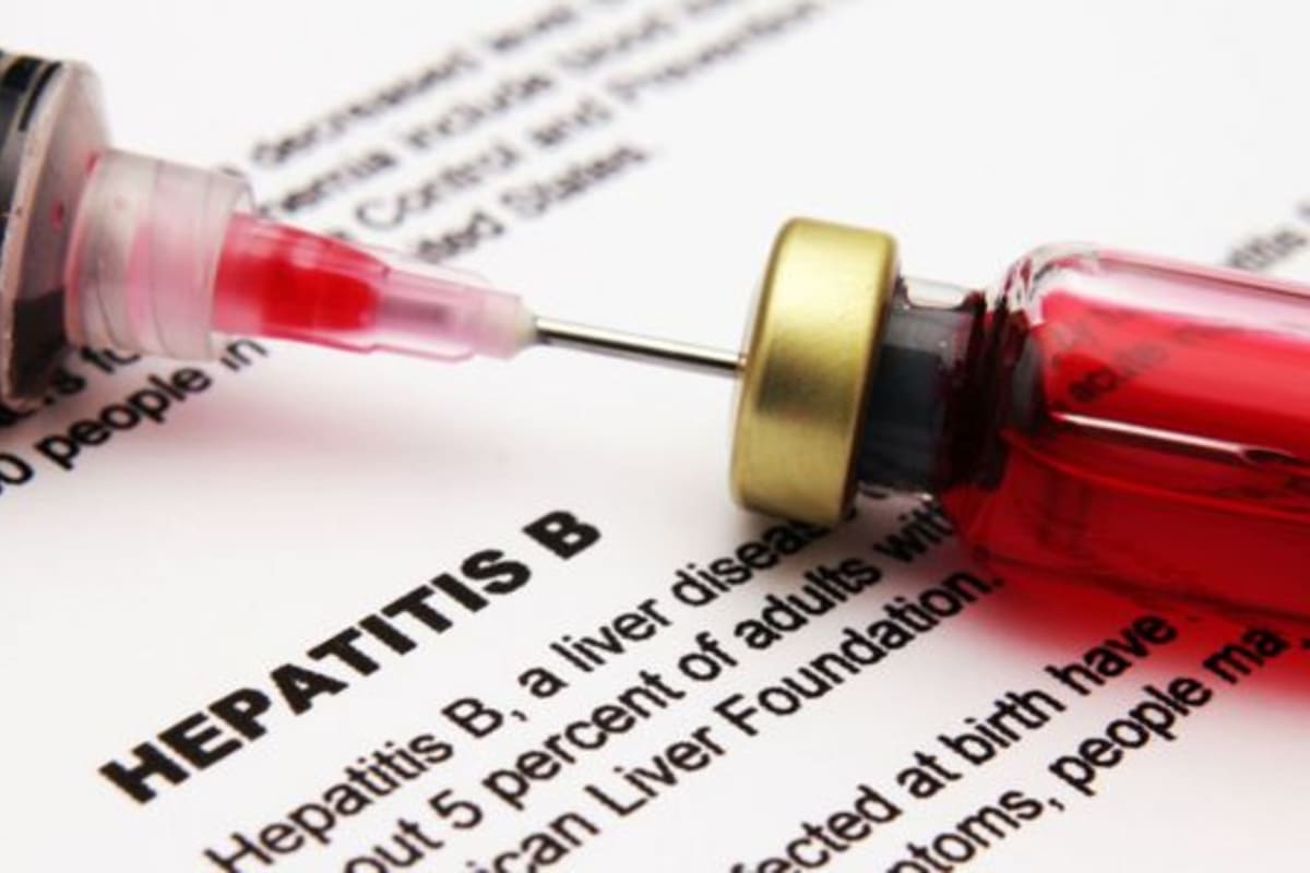 La hepatitis B se transmite por vía sanguínea o sexual