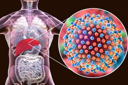 Se detectó el primer caso de hepatitis aguda infantil
