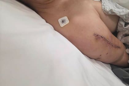 La herida en el brazo de Nadia Beller