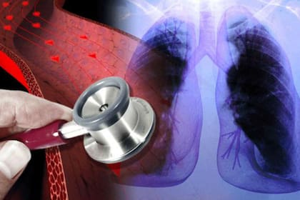 Una exposición constante al frío de las máquinas es peligroso para aquellos pacientes que sufren de asma, EPOC y otras patologías pulmonares, ya que pueden experimentar episodios de bronquitis