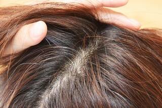 Estuve seis meses sin lavarme el pelo con shampoo y esto es lo que aprendí