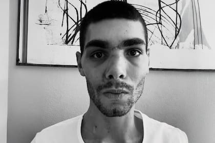 La imagen de Filippo Baroncini, después de la reconstrucción de su rostro