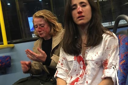 La imagen de la azafata y su novia tras el ataque en mayo pasado