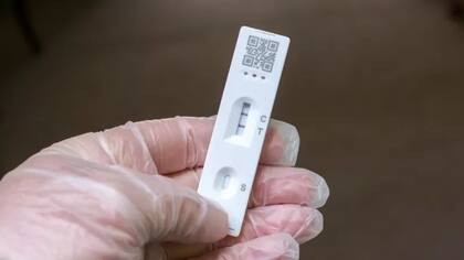 La imagen de un test de antígenos positivo