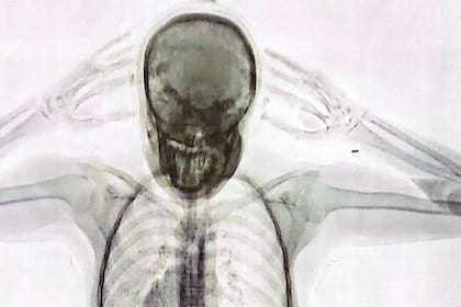 La imagen del cuerpo de la "mula" según el escáner