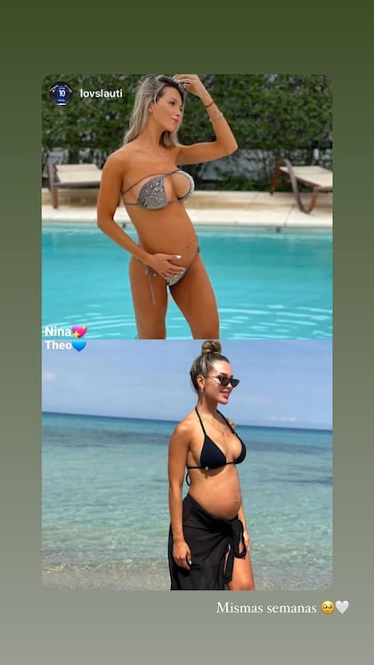 La imagen que compara los embarazos de Agus Gandolfo
