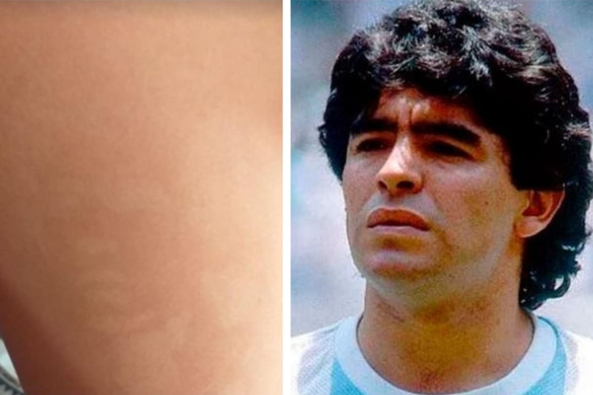 La imagen que un adolescente capturó de la pierna de su pareja. Crédito: Instagram